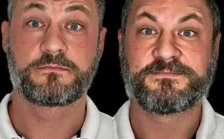 Energize Your Appearance via Profhilo at the Best Aesthetic Clinics in dubai