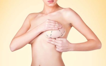 How Long Does Breast Augmentation in Dubai Last? Understanding the Longevity of Implants
