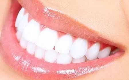 Whitening for Sensitive Teeth: Is Laser a Good Option?