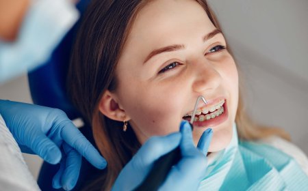 יישור שיניים באשדוד עם טכניקות מתקדמות כולל יישור שקוף וללא כאבים