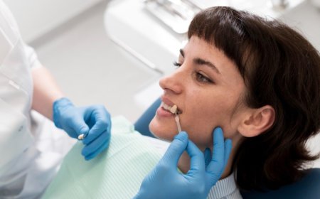 The Benefits of Choosing Same Day Dental Implants for Immediate Results