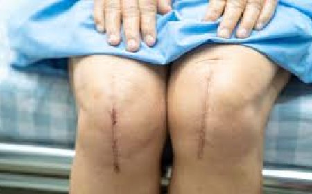 How Aspadol Tablet Helps with Post-Orthopedic Surgery Pain