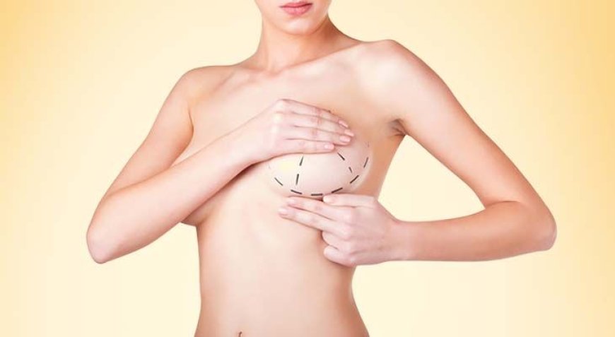 How Long Does Breast Augmentation in Dubai Last? Understanding the Longevity of Implants