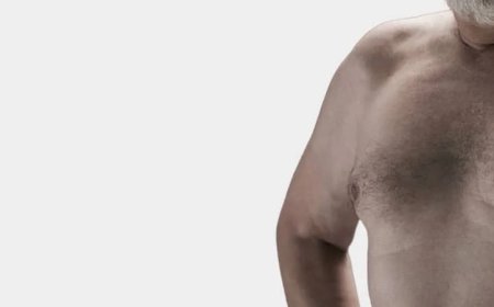 Unlocking Confidence: The Benefits of Gynecomastia Surgery