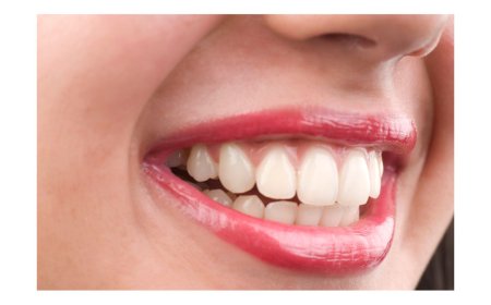 Tooth Pain at the Worst Time? How to Find Emergency Dental Care Fast