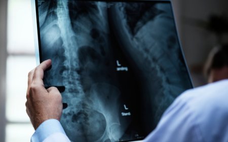 How Digital X-Rays Are Changing the Future of Medical Imaging