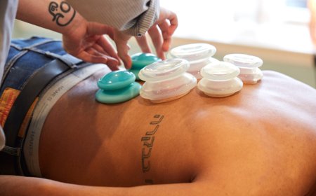 Cupping Therapy in Philadelphia: Ancient Healing Reimagined