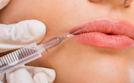 Can Russian Lip Fillers Improve Lip Symmetry?