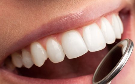 How to Choose the Right Type of Dental Crown in Dubai