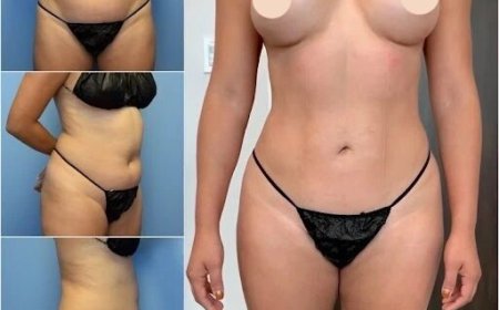 Best Body Contouring Surgeons in Dubai: Why Dubai is a Top Destination for Surgery