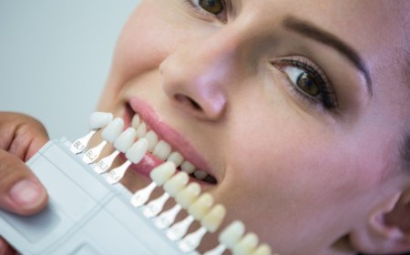 Everything You Need to Know About Getting a Zirconia Crown