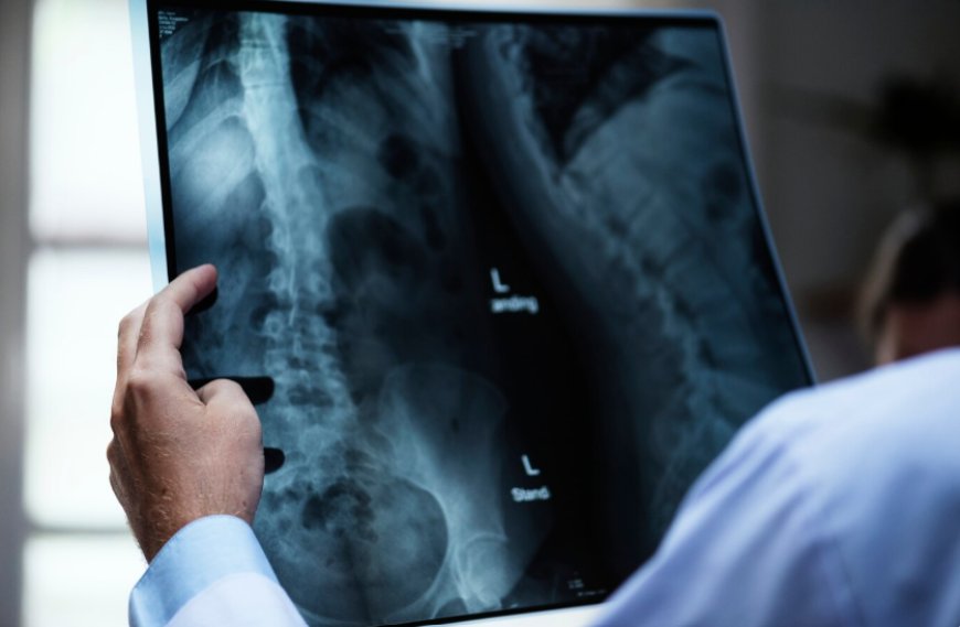 How Digital X-Rays Are Changing the Future of Medical Imaging
