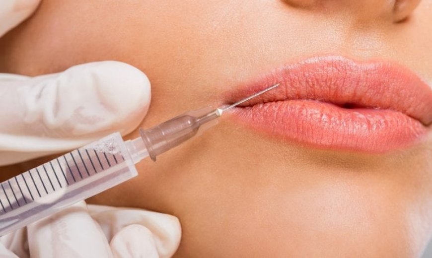 Can Russian Lip Fillers Improve Lip Symmetry?