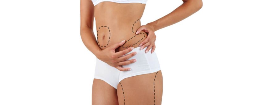 How Much Fat Can Be Removed with Liposuction?