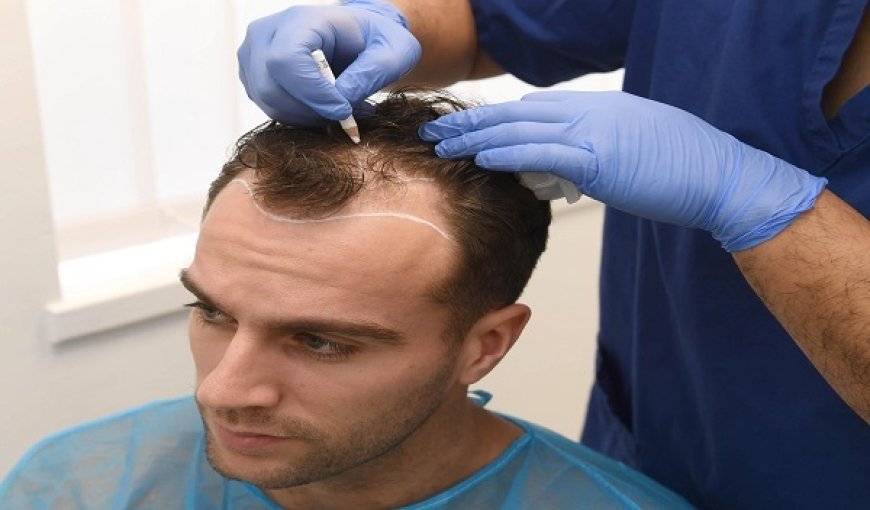 FUT Hair Transplant in Islamabad: Is It Still Relevant?